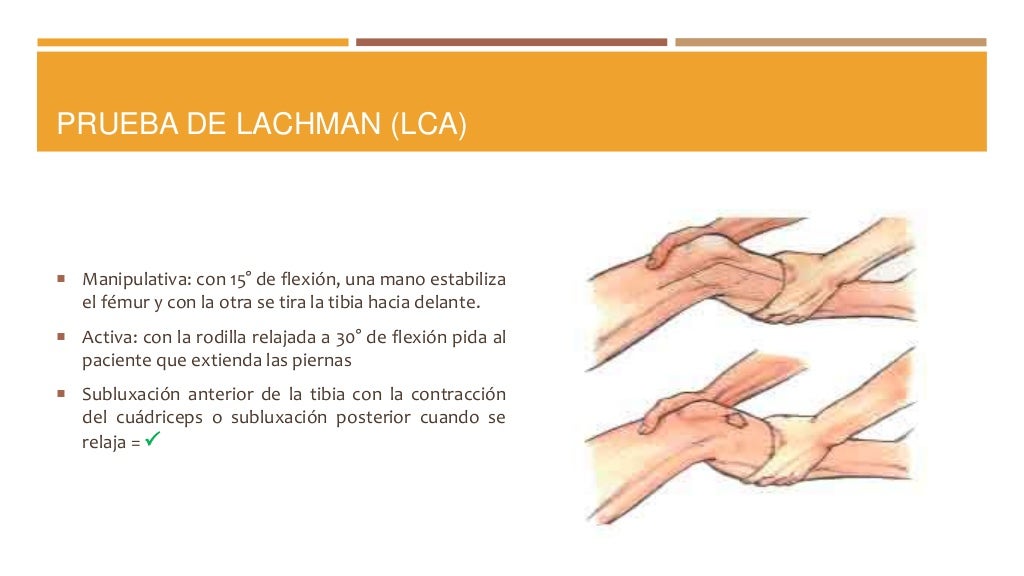 Maniobras en la exploración de rodilla