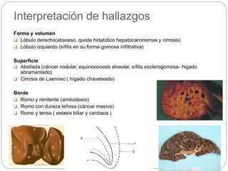 MANIOBRAS SEMIO II ABDOMINAL.pptx