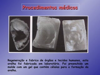 Procedimentos médicos




Regeneração e fabrico de órgãos e tecidos humanos, esta
orelha foi fabricada em laboratório. Foi preenchido um
molde com um gel que contém células para a formação da
orelha.
 