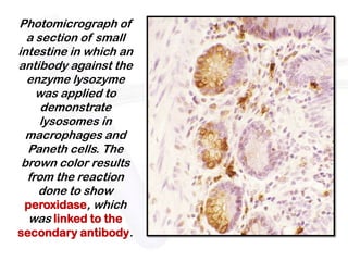 Photomicrograph of
  a section of small
intestine in which an
antibody against the
  enzyme lysozyme
    was applied to
     demonstrate
     lysosomes in
  macrophages and
  Paneth cells. The
 brown color results
  from the reaction
    done to show
 peroxidase, which
  was linked to the
secondary antibody.
 