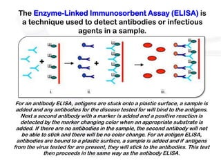 The Enzyme-Linked Immunosorbent Assay (ELISA) is
   a technique used to detect antibodies or infectious
                  agents in a sample.




 For an antibody ELISA, antigens are stuck onto a plastic surface, a sample is
 added and any antibodies for the disease tested for will bind to the antigens.
   Next a second antibody with a marker is added and a positive reaction is
   detected by the marker changing color when an appropriate substrate is
 added. If there are no antibodies in the sample, the second antibody will not
   be able to stick and there will be no color change. For an antigen ELISA,
 antibodies are bound to a plastic surface, a sample is added and if antigens
from the virus tested for are present, they will stick to the antibodies. This test
            then proceeds in the same way as the antibody ELISA.
 
