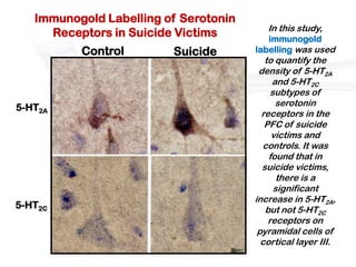 Immunogold Labelling of Serotonin
                                          In this study,
     Receptors in Suicide Victims         immunogold
          Control        Suicide       labelling was used
                                          to quantify the
                                        density of 5-HT2A
                                            and 5-HT2C
                                            subtypes of
                                             serotonin
5-HT2A
                                         receptors in the
                                          PFC of suicide
                                            victims and
                                         controls. It was
                                           found that in
                                         suicide victims,
                                              there is a
                                             significant
                                       increase in 5-HT2A,
5-HT2C                                    but not 5-HT2C
                                           receptors on
                                        pyramidal cells of
                                         cortical layer III.
 