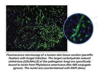 Fluorescence microscopy of a human skin tissue section (paraffin
  fixation) with fungal infection. The target carbohydrate subunit
  chitotriose [(GlcNAc)3] of the pathogenic fungi are specifically
  bound to lectin from Phytolacca americana-Atto 488 conjugate
      (green). The nuclei are counterstained with DAPI (blue).
 