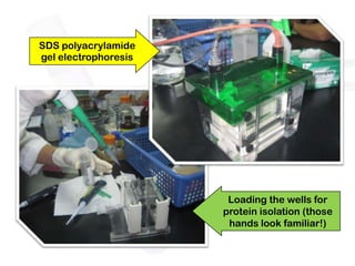 SDS polyacrylamide
gel electrophoresis




                       Loading the wells for
                      protein isolation (those
                       hands look familiar!)
 