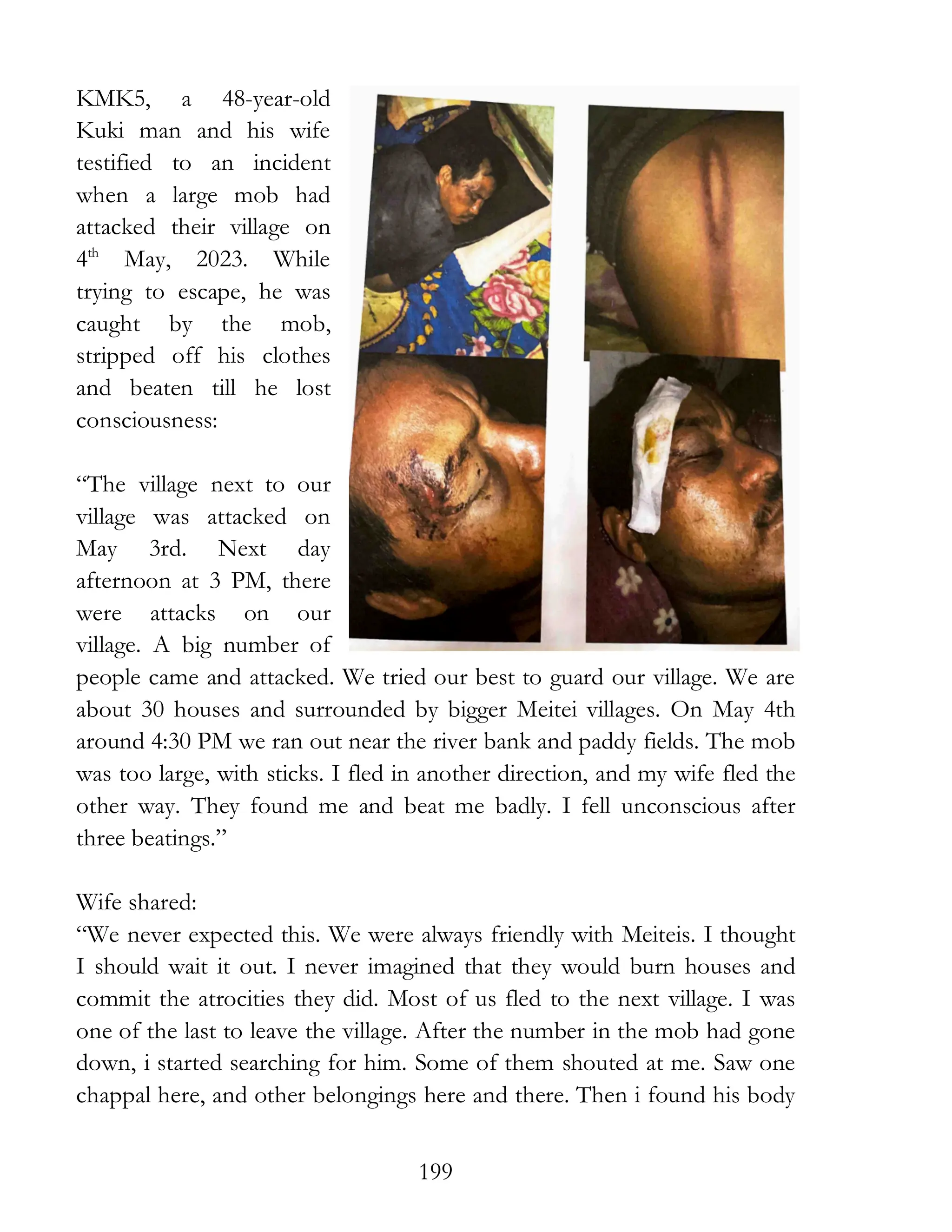 199
KMK5, a 48-year-old
Kuki man and his wife
testified to an incident
when a large mob had
attacked their village on
4th
May, 2023. While
trying to escape, he was
caught by the mob,
stripped off his clothes
and beaten till he lost
consciousness:
“The village next to our
village was attacked on
May 3rd. Next day
afternoon at 3 PM, there
were attacks on our
village. A big number of
people came and attacked. We tried our best to guard our village. We are
about 30 houses and surrounded by bigger Meitei villages. On May 4th
around 4:30 PM we ran out near the river bank and paddy fields. The mob
was too large, with sticks. I fled in another direction, and my wife fled the
other way. They found me and beat me badly. I fell unconscious after
three beatings.”
Wife shared:
“We never expected this. We were always friendly with Meiteis. I thought
I should wait it out. I never imagined that they would burn houses and
commit the atrocities they did. Most of us fled to the next village. I was
one of the last to leave the village. After the number in the mob had gone
down, i started searching for him. Some of them shouted at me. Saw one
chappal here, and other belongings here and there. Then i found his body
 