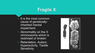 Fragile X
• It is the most common
cause of genetically-
inherited mental
impairment.
• Abnormality on the X
chromosome which is
restricted or broken
• Retardation, Autism,
Hyperactivity, Tactile
Sensitivity
 