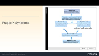 Copyright © 2017 Pearson, Inc. All Rights Reserved
Fragile X Syndrome
 