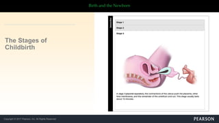 Copyright © 2017 Pearson, Inc. All Rights Reserved
Birth and the Newborn
The Stages of
Childbirth
 