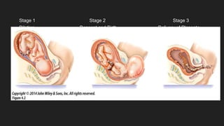 Stage 1 Stage 2 Stage 3
Dilation Descent and Birth Delivery of Placenta
 
