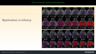 Copyright © 2017 Pearson, Inc. All Rights Reserved
Physical Growth and Brain Development
Myelination in Infancy
 