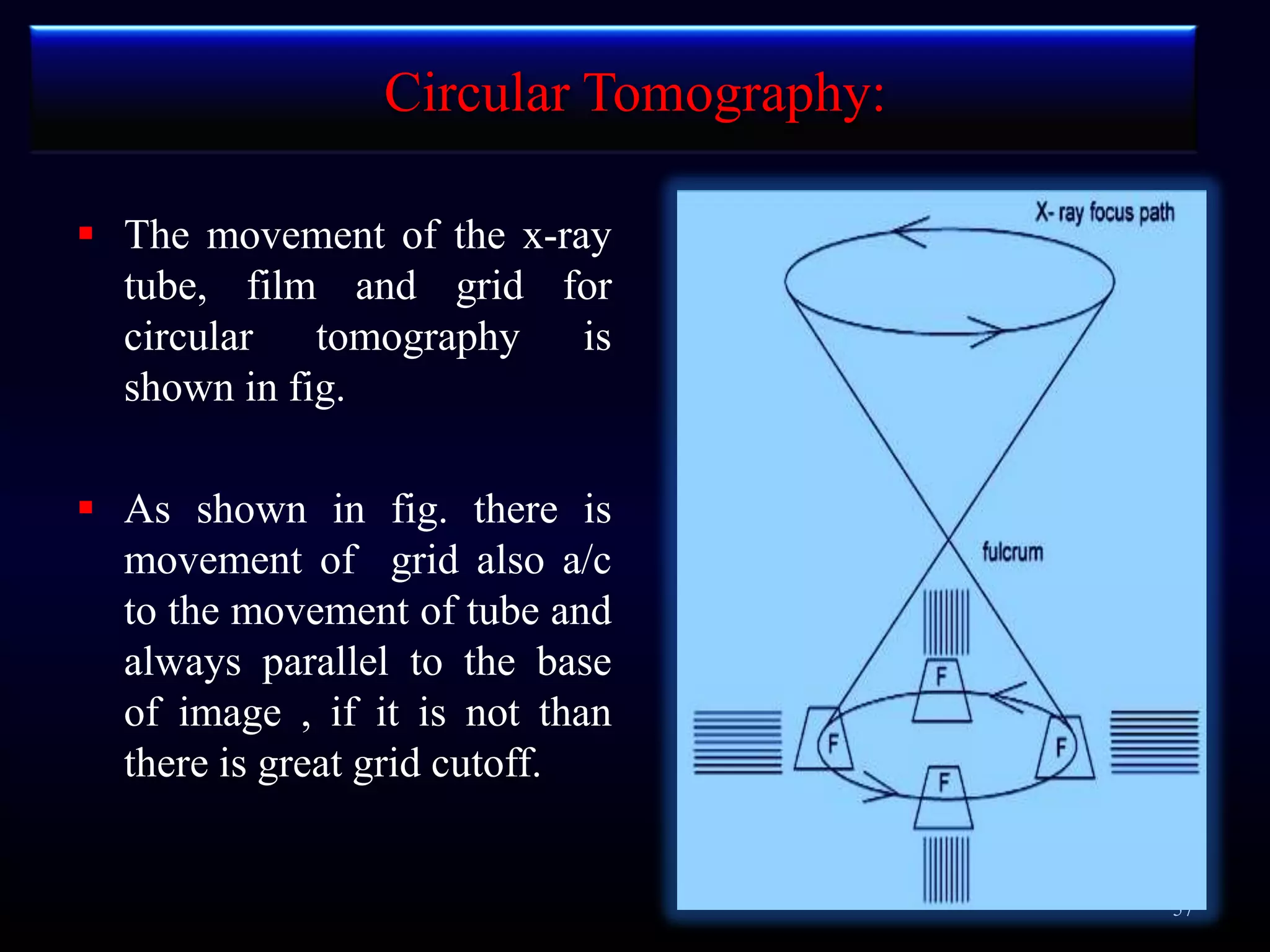 tomography tomography - Presentation Transcript 1. PRINCIPLE ...