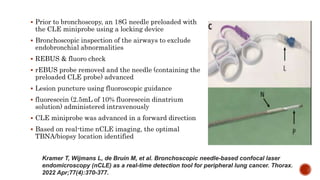Rebus Probe Manjunath New in IP napcon.pptx