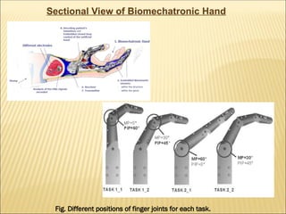 human design by biomechatronic approach Manju ppt.ppt