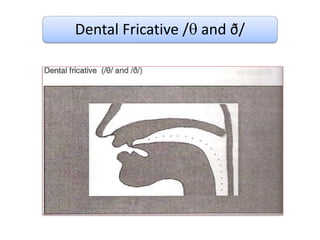 Dental Fricative / and ð/
 