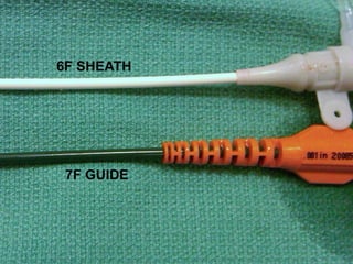 6F SHEATH




 7F GUIDE
 