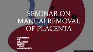 SEMINAR ON
MANUALREMOVAL
OF PLACENTA
This Photo by Unknown author is licensed under CC BY-NC-ND.
SUBMITTED
TO-
MS. SAPNA
KUMARI
TUTOR
AIN,GUWAHATI
 