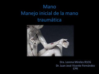 Mano
Manejo inicial de la mano
traumática
Dra. Lorena Mireles R1CG
Dr. Juan José Vicente Fernández
CPR
 