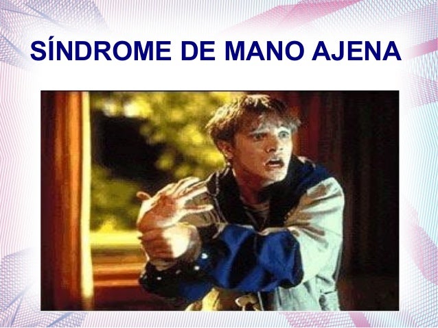 Síndrome de la Mano ajena