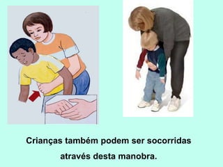 Crianças também podem ser socorridas
       através desta manobra.
 