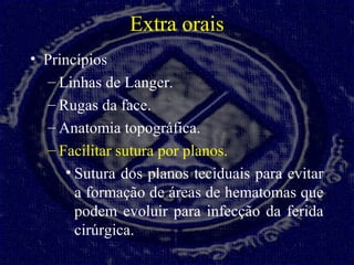 Extra orais
• Princípios
– Linhas de Langer.
– Rugas da face.
– Anatomia topográfica.
– Facilitar sutura por planos.
• Sut...