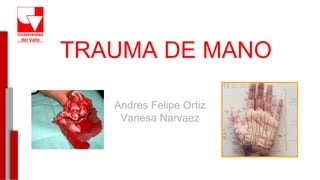 TRAUMA DE MANO
Andres Felipe Ortiz
Vanesa Narvaez
-
 