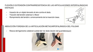FLEXIÓN O EXTENSIÓN CONTRARRESISTENCIA DE LAS ARTICULACIONES INTERFALÁNGICAS
DISTALES
- Impacto de un objeto lanzado al aire contra el dedo.
- Tracción del tendón extensor o flexor
- Rompimiento del tendón o arrancamiento de la inserción ósea.
ABDUCCIÓN FORZADA DE LA ARTICULACIÓN METACARPOFALÁNGICA DEL PULGAR
- Rotura del ligamento colateral cubital del 1er dedo (lesión del guardabosque)
-
 
