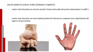 GOLPE DIRECTO CON EL PUÑO CERRADO O ABIERTO
- Lesión más frecuente con el puño cerrado: fractura del cuello del quinto metacarpiano (“nudillo”).
- Lesión más frecuente con mano abierta puede dar fracturas en cualquier zona, dependiendo del
lugar en el que asiente.
-
 