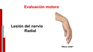 -
Evaluación motora
Lesión del nervio
Radial
 