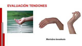 EVALUACIÓN TENDONES
eVALICAICON TENDONES
Maniobra tenodesis-
 