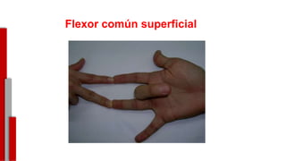 Flexor común superficial
-
 