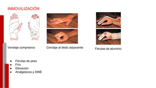 INMOVILIZACIÓN
Vendaje compresivo Cerclaje al dedo adyacente Férulas de aluminio
● Férulas de yeso
● Frío
● Elevación
● Analgésicos y AINE
-
 