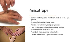 Plastic surgery introduction (Grafts and Flaps).pptx