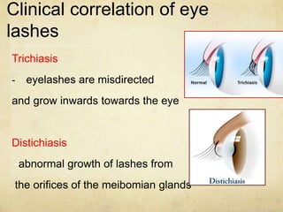 eyelid | PPTX
