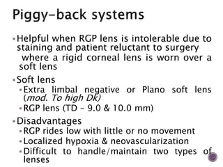 High Riding Rgp Therapeutic Contact lenses | PPTX
