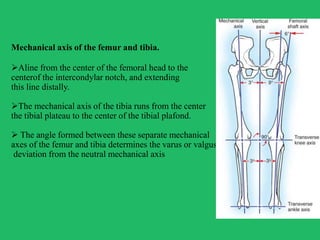TOTAL KNEE REPLACEMENT | PPTX
