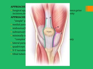 TOTAL KNEE REPLACEMENT | PPTX