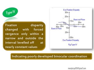 Fixation disparity
changed with forced
vergence only within a
narrow and outside the
interval levelled off at
nearly constant values
Indicating poorly developed binocular coordination
manojaryal85@gmail.com
 