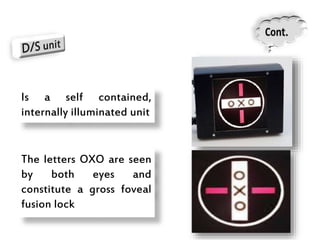 Is a self contained,
internally illuminated unit
The letters OXO are seen
by both eyes and
constitute a gross foveal
fusion lock
 
