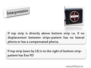 If top strip is directly above bottom strip i.e. if no
displacement between strips-patient has no lateral
phoria or has a compensated phoria.
If top strip (seen by LE) is to the right of bottom strip-
patient has Exo FD
manojaryal85@gmail.com
 