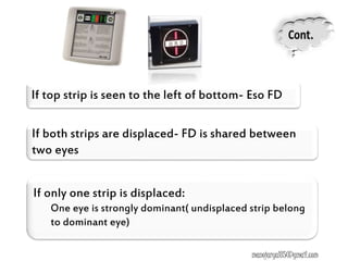 If top strip is seen to the left of bottom- Eso FD
If both strips are displaced- FD is shared between
two eyes
If only one strip is displaced:
One eye is strongly dominant( undisplaced strip belong
to dominant eye)
manojaryal85@gmail.com
 