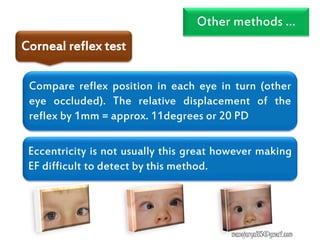 Other methods …
Compare reflex position in each eye in turn (other
eye occluded). The relative displacement of the
reflex by 1mm = approx. 11degrees or 20 PD
Eccentricity is not usually this great however making
EF difficult to detect by this method.
Corneal reflex test
manojaryal85@gmail.com
 