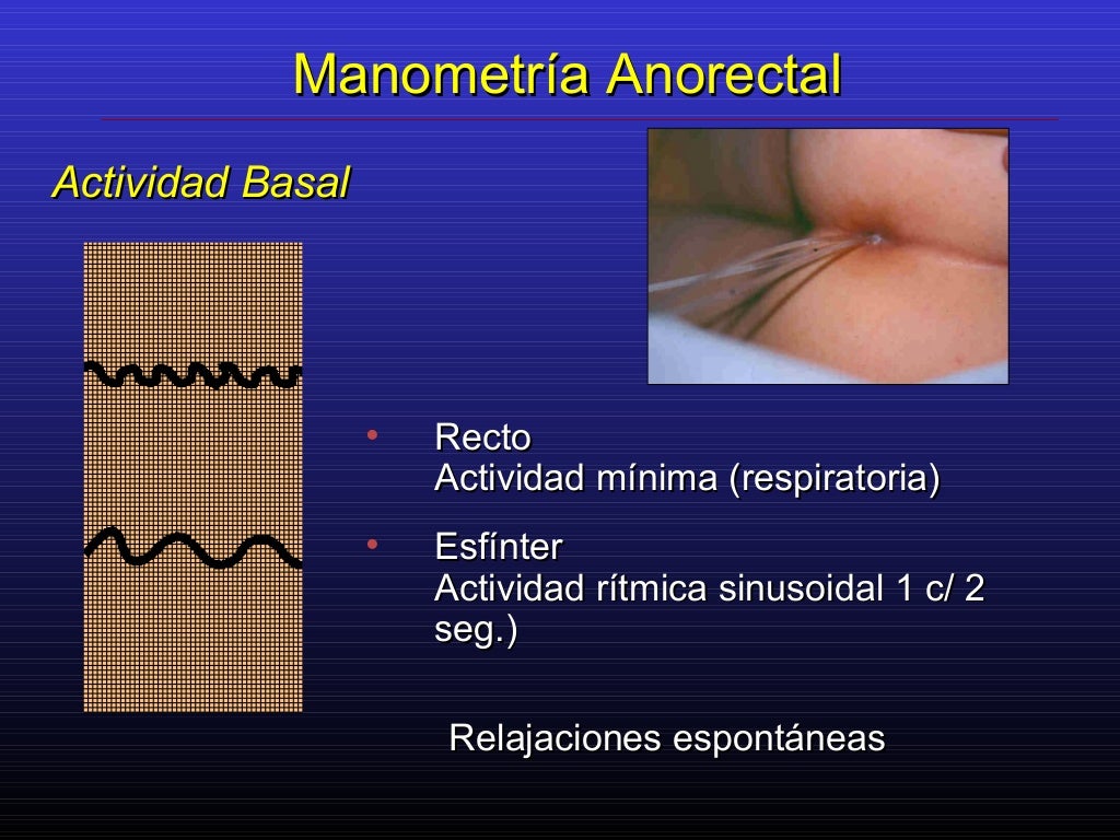 Manometria Anorretal Onde Fazer Sp Manometria Anorectal Quito