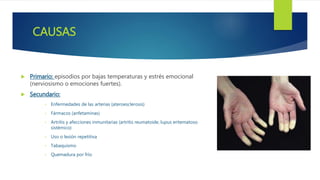 CAUSAS
 Primario: episodios por bajas temperaturas y estrés emocional
(nerviosismo o emociones fuertes).
 Secundario:
• Enfermedades de las arterias (ateroesclerosis)
• Fármacos (anfetaminas)
• Artritis y afecciones inmunitarias (artritis reumatoide, lupus eritematoso
sistémico)
• Uso o lesión repetitiva
• Tabaquismo
• Quemadura por frío
 