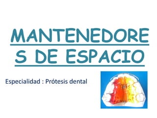 MANTENEDORE
S DE ESPACIO
Especialidad : Prótesis dental
 