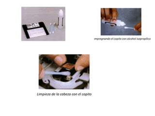 Impregnando el copito con alcohol isopropílicoLimpieza de la cabeza con el copito