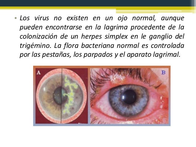 Para Qué Sirven Los Lentes De Contacto 2025