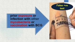 prior exposure or
infection with other
mycobacteria or
vaccination with BCG
False +ve
test
 