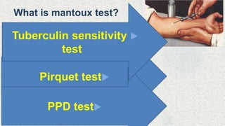 What is mantoux test?
Pirquet test
PPD test
Tuberculin sensitivity
test
 