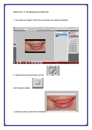 PRACTICA 4º “BLANQUEO DE DIENTES”



1° se inserta la imagen a Ps4 de una sonrisa con dientes amarillos




2° seleccionas la herramienta “pincel”




y de mascara rápida




y coloreas solo la parte de los dientes
 