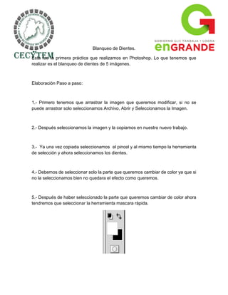 Blanqueo de Dientes.

Esta fue la primera práctica que realizamos en Photoshop. Lo que tenemos que
realizar es el blanqueo de dientes de 5 imágenes.



Elaboración Paso a paso:



1.- Primero tenemos que arrastrar la imagen que queremos modificar, si no se
puede arrastrar solo seleccionamos Archivo, Abrir y Seleccionamos la Imagen.



2.- Después seleccionamos la imagen y la copiamos en nuestro nuevo trabajo.



3.- Ya una vez copiada seleccionamos el pincel y al mismo tiempo la herramienta
de selección y ahora seleccionamos los dientes.



4.- Debemos de seleccionar solo la parte que queremos cambiar de color ya que si
no la seleccionamos bien no quedara el efecto como queremos.



5.- Después de haber seleccionado la parte que queremos cambiar de color ahora
tendremos que seleccionar la herramienta mascara rápida.
 